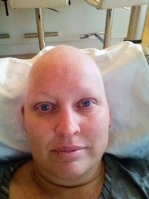 Trish During Chemotherapy